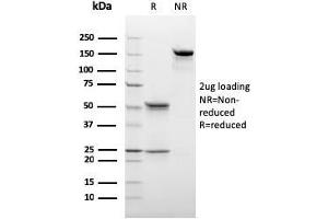 SDS-PAGE Analysis Purified C1QB Mouse Monoclonal Antibody (C1QB/2966). (C1QB antibody  (AA 41-188))