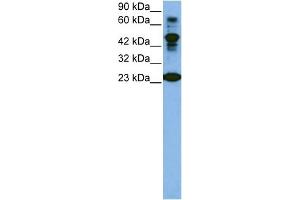 WB Suggested Anti-CDK2 Antibody Titration:  1 ug/ml  Positive Control:  Jurkat cell lysate CDK2 is strongly supported by BioGPS gene expression data to be expressed in Human Jurkat cells (CDK2 antibody  (C-Term))