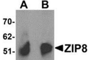 Western blot analysis of ZIP8 in human spleen tissue lysate with ZIP8 antibody at (A) 1 and (B) 2 μg/ml. (SLC39A8 antibody  (C-Term))