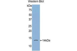 Detection of recombinant FKBP1A using Polyclonal Antibody to FK506 Binding Protein 1A (FKBP1A) (FKBP1A antibody  (AA 2-108))