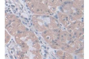 Detection of PGM1 in Human Stomach Tissue using Polyclonal Antibody to Phosphoglucomutase 1 (PGM1) (Phosphoglucomutase 1 antibody  (AA 1-235))