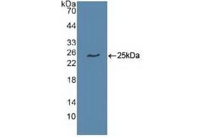 Detection of Recombinant UBE2C, Human using Polyclonal Antibody to Ubiquitin Conjugating Enzyme E2C (UBE2C) (UBE2C antibody  (AA 2-179))