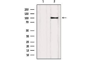 Western blot analysis of extracts from Myeloma cells, using Drebrin Antibody. (DBN1 antibody  (Internal Region))