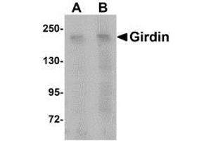 Western blot analysis of Girdin in rat brain tissue lysate with AP30364PU-N Girdin antibody at (A) 1 and (B) 2 μg/ml.