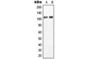 Western blot analysis of NGEP expression in MCF7 (A), NIH3T3 (B) whole cell lysates. (Anoctamin 7 antibody  (C-Term))