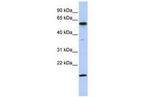 Image no. 1 for anti-Thyroid Hormone Receptor Interactor 10 (TRIP10) (C-Term) antibody (ABIN6742770) (TRIP10 antibody  (C-Term))