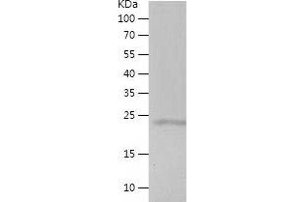MED28 Protein (AA 1-178) (His tag)