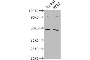 Western Blot Positive WB detected in: Jurkat whole cell lysate, K562 whole cell lysate All lanes: PSMD6 antibody at 1:2000 Secondary Goat polyclonal to rabbit IgG at 1/50000 dilution Predicted band size: 46, 42, 52 kDa Observed band size: 46 kDa (PSMD6 antibody  (Regulatory Subunit 6))