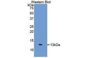 Western Blotting (WB) image for anti-Interleukin 6 Receptor (IL6R) (AA 385-462) antibody (ABIN3206018)