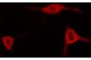 ABIN6278550 staining Hela cells by IF/ICC. (AIFM2 antibody  (Internal Region))