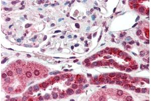 Human Kidney (formalin-fixed, paraffin-embedded) stained with NR3C2 antibody ABIN396956 at 1:50 followed by biotinylated anti-mouse IgG secondary antibody ABIN481714, alkaline phosphatase-streptavidin and chromogen. (NR3C2 antibody)