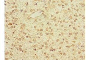 ZNF774 antibody  (AA 101-300)