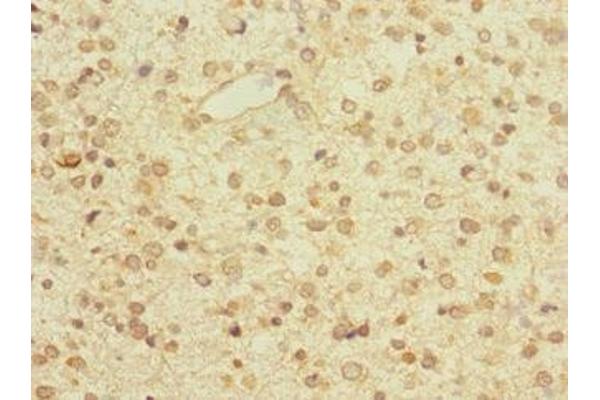 ZNF774 antibody  (AA 101-300)