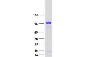Validation with Western Blot (CORO1B Protein (Transcript Variant 2) (Myc-DYKDDDDK Tag))