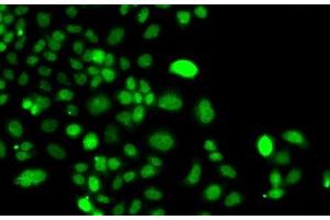 Immunofluorescence analysis of A549 cells using PIP4K2A Polyclonal Antibody (PIP4K2A antibody)