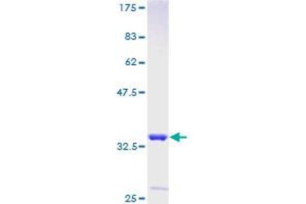 LARP7 Protein (AA 1-31) (GST tag)