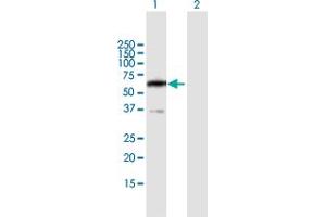 PPP2R5B Antikörper  (AA 1-497)