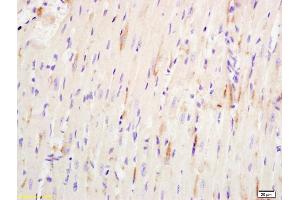 Formalin-fixed and paraffin embedded mouse heart labeled with Anti-ATP4B Polyclonal Antibody, Unconjugated (ABIN740205) at 1:200 followed by conjugation to the secondary antibody and DAB staining. (ATP4b antibody  (AA 201-291))