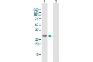 Western Blot analysis of DLX1 expression in transfected 293T cell line by DLX1 MaxPab polyclonal antibody. (DLX1 antibody  (AA 1-255))