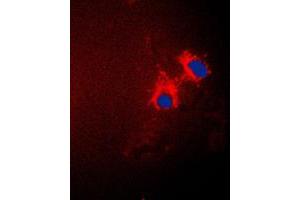 Immunofluorescent analysis of p15 INK4b staining in A549 cells. (CDKN2B antibody  (C-Term))