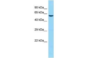 WB Suggested Anti-Jakmip1 Antibody   Titration: 1.