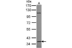 WB Image Sample (30 ug of whole cell lysate) A: HeLa 7. (TRIM27 antibody)