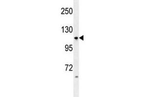 Anti-LGR5 antibody western blot analysis in HL-60 lysate (LGR5 antibody  (AA 605-638))
