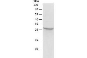 Western Blotting (WB) image for Hydroxyprostaglandin Dehydrogenase 15-(NAD) (HPGD) (AA 1-266) protein (His tag) (ABIN7123382) (HPGD Protein (AA 1-266) (His tag))