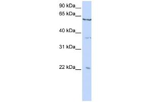 WB Suggested Anti-CSRP2 Antibody Titration:  0.