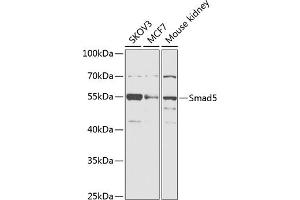 Western blot analysis of extracts of various cell lines, using Smad5 antibody (ABIN6128714, ABIN6148090, ABIN6148091 and ABIN6218232) at 1:1000 dilution. (SMAD5 antibody  (AA 186-465))
