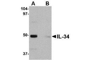 Image no. 1 for anti-Interleukin 34 (IL34) (Internal Region) antibody (ABIN342710) (IL-34 antibody  (Internal Region))