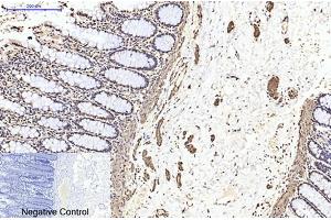 Immunohistochemical analysis of paraffin-embedded human colon tissue. (TUBB2A antibody)