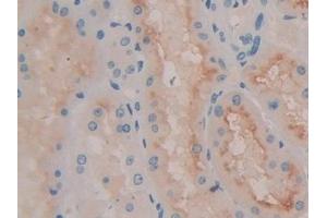 Immunohistochemistry (IHC) image for anti-Quiescin Q6 Sulfhydryl Oxidase 1 (QSOX1) (AA 394-519) antibody (ABIN7440086)