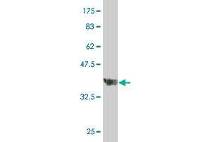 Western Blot detection against Immunogen (37. (EXTL1 antibody  (AA 141-241))