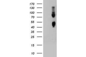 Image no. 1 for anti-Carboxypeptidase O (CPO) antibody (ABIN1497097)