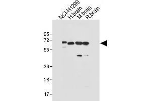 Western Blotting (WB) image for anti-delta Like Protein 3 (DLL3) (AA 519-548), (C-Term) antibody (ABIN653276)