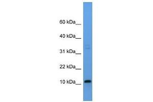 Western Blot showing Cyyr1 antibody used at a concentration of 1-2 ug/ml to detect its target protein. (CYYR1 antibody  (Middle Region))