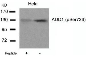 Western blot analysis of extracts from Hela cells using ADD1(Phospho-Ser726) Antibody and the same antibody preincubated with blocking peptide. (alpha Adducin antibody  (pSer726))