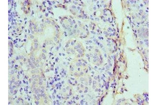 CST1 antibody  (AA 20-141)