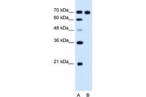 Western Blotting (WB) image for anti-Ribonucleotide Reductase M1 (RRM1) antibody (ABIN2462919) (RRM1 antibody)