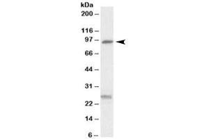Western blot testing of human kidney lysate with SLC4A11 antibody at 0. (SLC4A11 antibody)