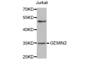 Western blot analysis of extracts of Jurkat cells, using GEMIN2 antibody. (SIP1 antibody)