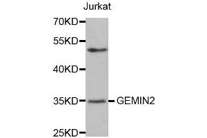 Western blot analysis of extracts of Jurkat cells, using GEMIN2 antibody.