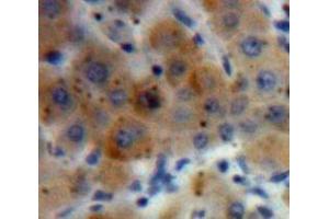 Used in DAB staining on fromalin fixed paraffin-embedded Liver tissue (HYAL2 antibody  (AA 23-447))