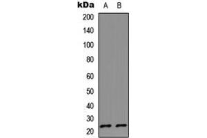 Western blot analysis of IL-17D expression in HeLa (A), Jurkat (B) whole cell lysates. (IL17D antibody  (C-Term))