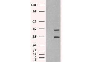 Image no. 2 for anti-Sirtuin 3 (SIRT3) (C-Term) antibody (ABIN374622) (SIRT3 antibody  (C-Term))