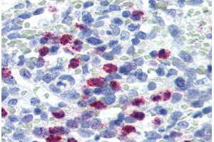 Human Spleen (formalin-fixed, paraffin-embedded) stained with FBXW7 antibody ABIN364303 at 5 ug/ml followed by biotinylated goat anti-rabbit IgG secondary antibody ABIN481713, alkaline phosphatase-streptavidin and chromogen. (FBXW7 antibody  (Internal Region))