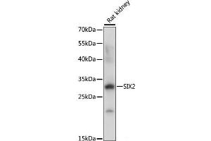 Western blot analysis of extracts of Rat kidney using SIX2 Polyclonal Antibody at dilution of 1:1000. (SIX2 antibody)
