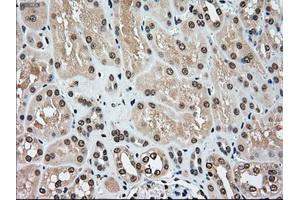 Immunohistochemical staining of paraffin-embedded Kidney tissue using anti-MAP2K4mouse monoclonal antibody.