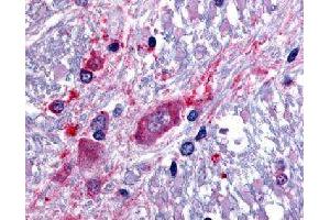 Immunohistochemical (Formalin/PFA-fixed paraffin-embedded sections) staining in human spinal cord with SLC5A3 polyclonal antibody . (SLC5A3 antibody)